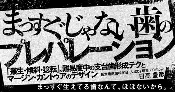 まっすぐじゃない歯のプレパレーション