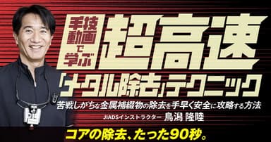 手技動画で学ぶ、超高速「メタル除去」テクニック