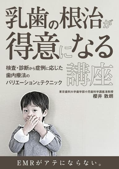 ランキング7位の乳歯の根治が得意になる講座