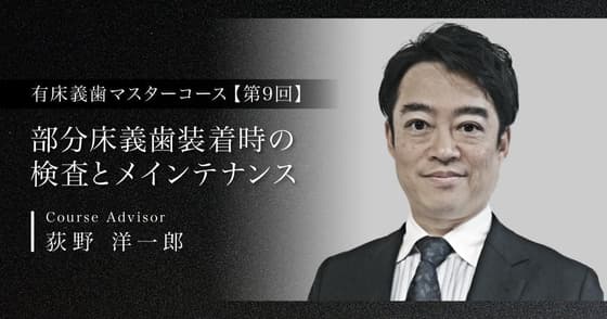 部分床義歯装着時の検査とメインテナンス