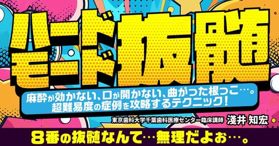 ハードモード抜髄