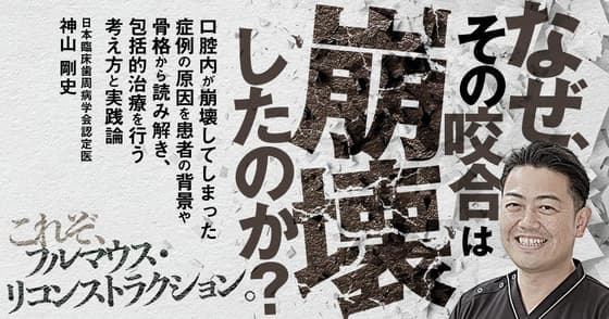 なぜ、その咬合は崩壊したのか？
