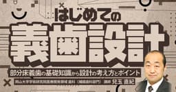 はじめての「義歯設計」