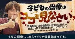 子どもの治療はココを見なさい