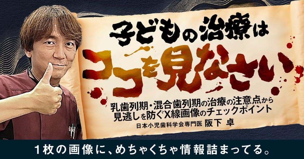 子どもの治療はココを見なさい - 乳歯列期・混合歯列期の治療の注意点から見逃しを防ぐX線画像のチェックポイント