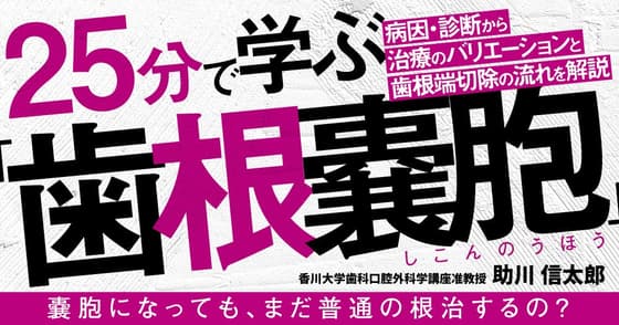 25分で学ぶ「歯根嚢胞」