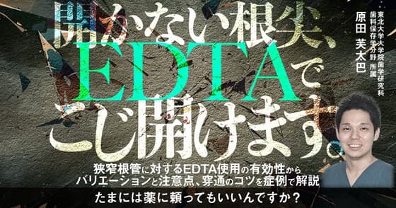開かない根尖、EDTAでこじ開けます。