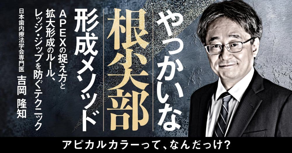 やっかいな「根尖部」形成メソッド