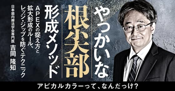 やっかいな「根尖部」形成メソッド