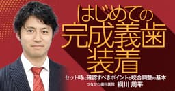 はじめての「完成義歯装着」