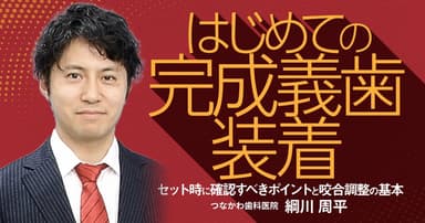 はじめての「完成義歯装着」