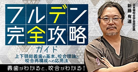 フルデン完全攻略ガイド