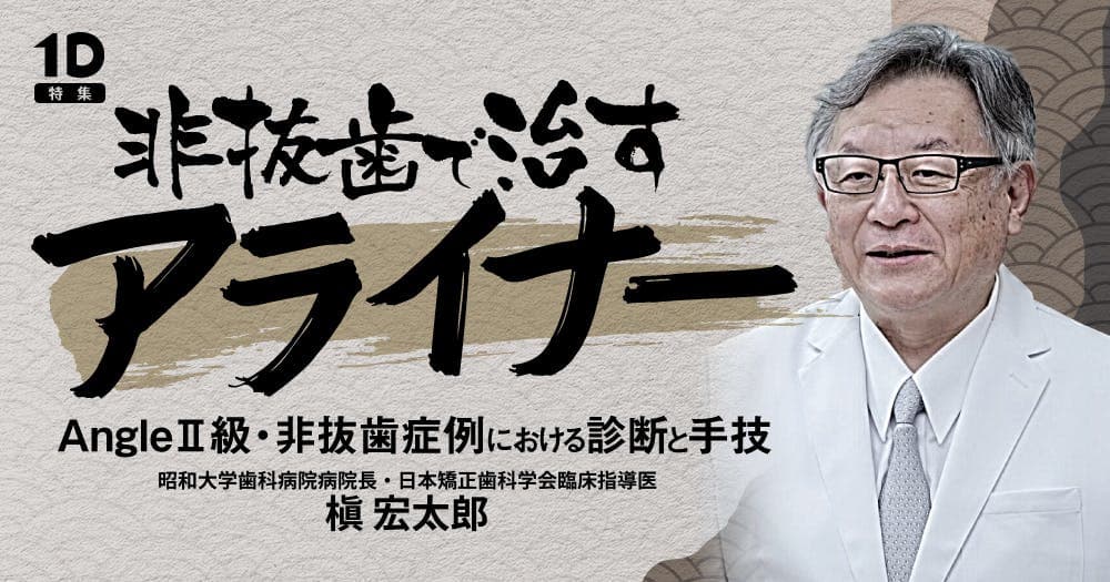 非抜歯で治すアライナー