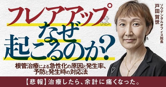 フレアアップはなぜ起こるのか？