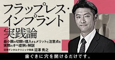 フラップレス・インプラント実践論