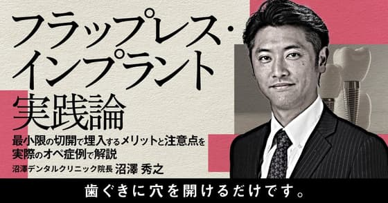 フラップレス・インプラント実践論