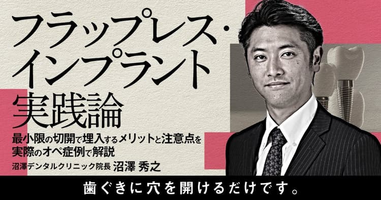 フラップレス・インプラント実践論