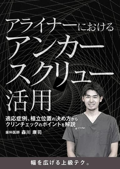 ランキング16位のアライナーにおけるアンカースクリュー活用
