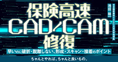 保険高速CAD/CAM修復