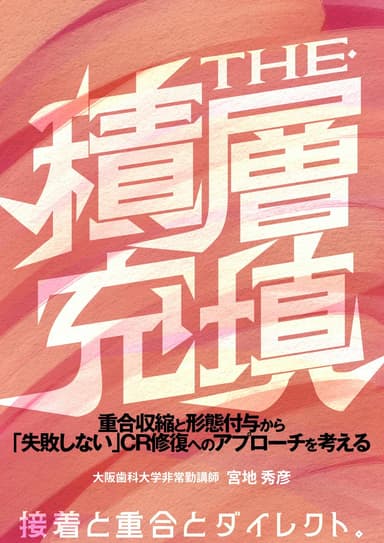 ランキング10位のTHE・積層充填