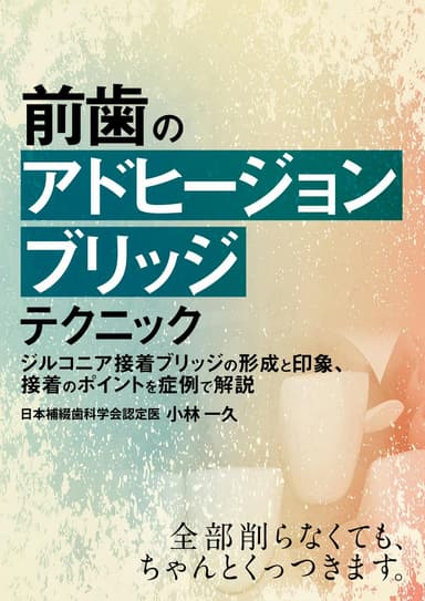 ランキング13位の前歯の「アドヒージョンブリッジ」テクニック