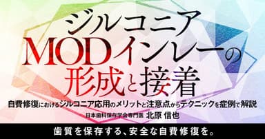 ジルコニアMODインレーの形成と接着