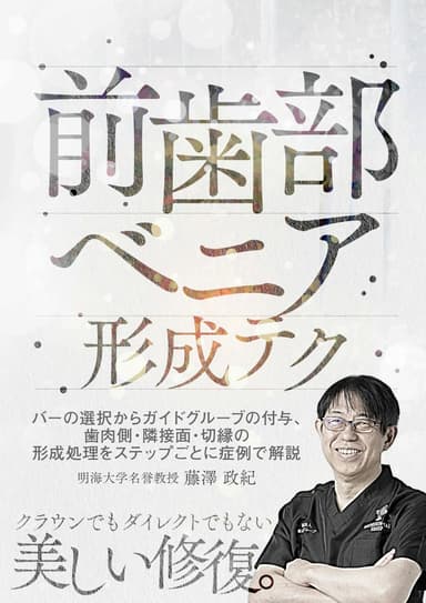ランキング8位の前歯部ベニア形成テク