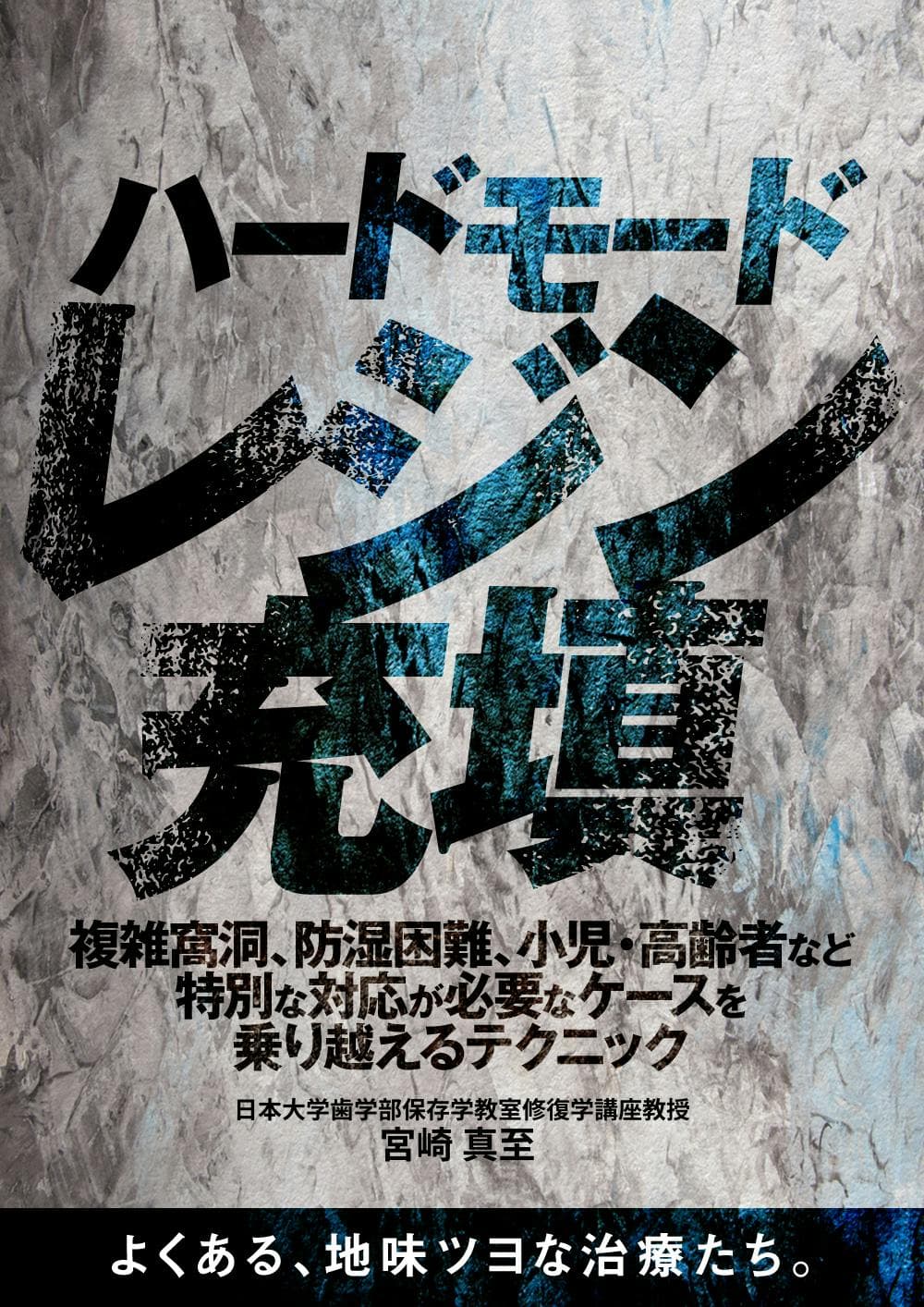 マトリックスバンド リテイナーの臨床応用とその手順。歯科医師・歯科衛生士が知っておくべき症例とメリット｜歯科オンラインセミナー・録画配信は1D（ワンディー）