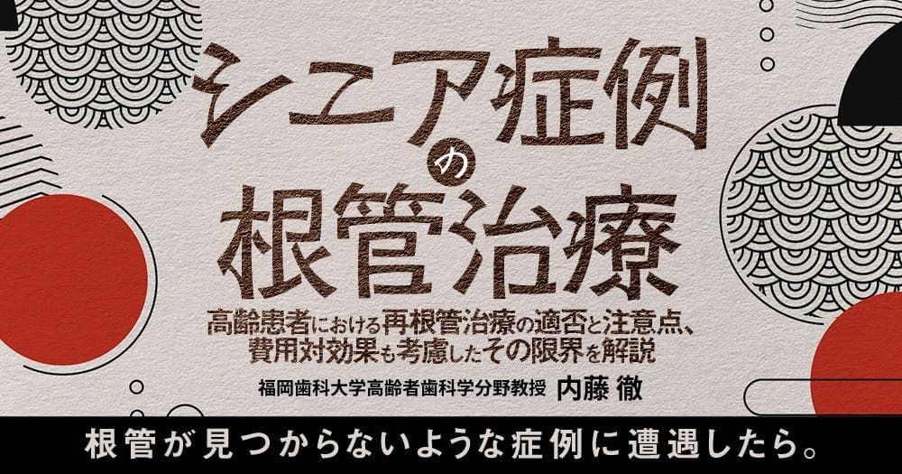シニア症例の根管治療 - 高齢患者における再根管治療の適否と注意点、費用対効果も考慮したその限界を解説