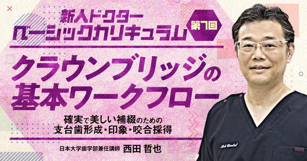 クラウンブリッジの基本ワークフロー