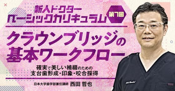 クラウンブリッジの基本ワークフロー