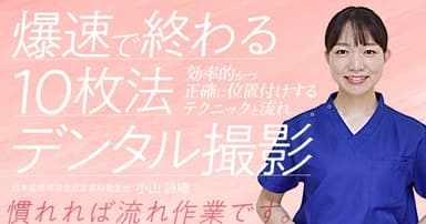 爆速で終わる10枚法デンタル撮影