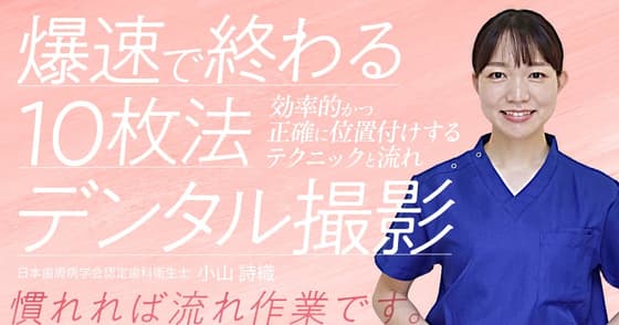 爆速で終わる10枚法デンタル撮影