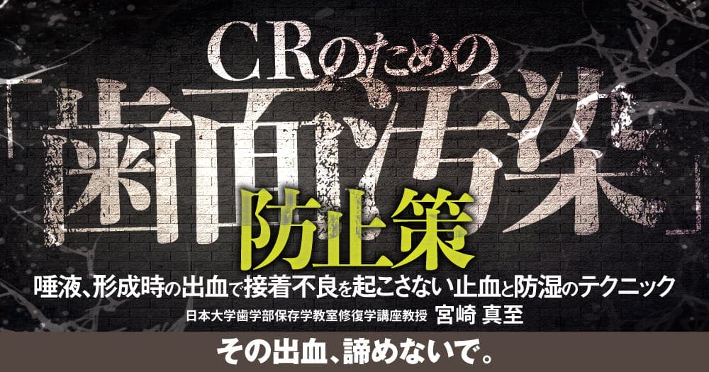 CRのための「歯面汚染」防止策
