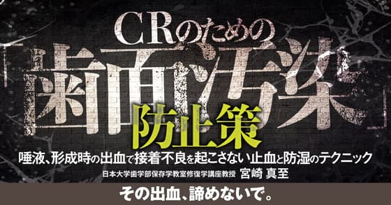 CRのための「歯面汚染」防止策