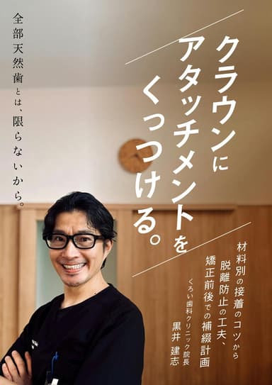 ランキング12位のクラウンにアタッチメントをくっつける。