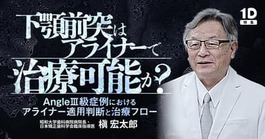 下顎前突はアライナーで治療可能か？