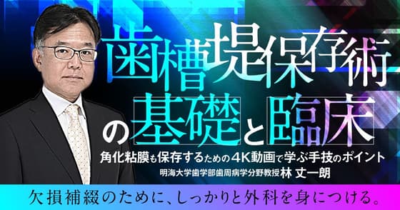 歯槽堤保存術の基礎と臨床