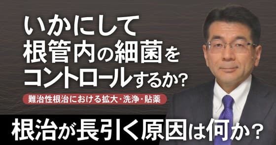 いかにして根管内の細菌をコントロールするか？細菌を減少・除去療法のコツは？