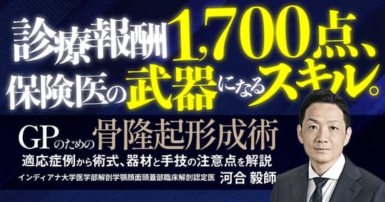 GPのための「骨隆起形成術」