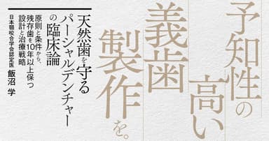 天然歯を守るパーシャルデンチャーの臨床論