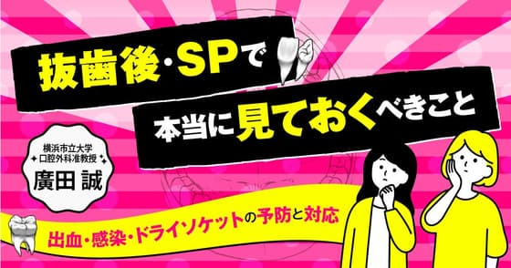 抜歯後・SPで本当に見ておくべきこと