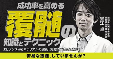 成功率を高める覆髄の知識とテクニック