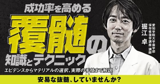 成功率を高める覆髄の知識とテクニック