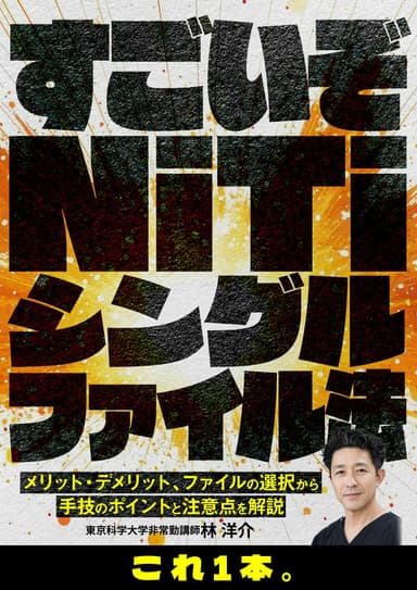 ランキング3位のすごいぞNiTiシングルファイル法