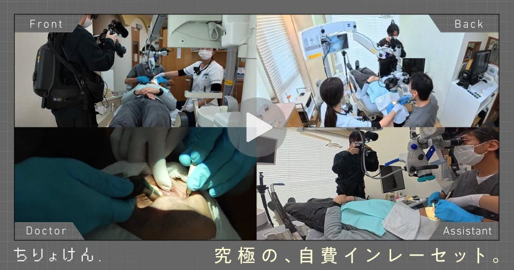 【治療見学】セラミックインレーセット（上顎左側第一大臼歯）