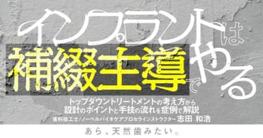 インプラントは補綴主導でやる