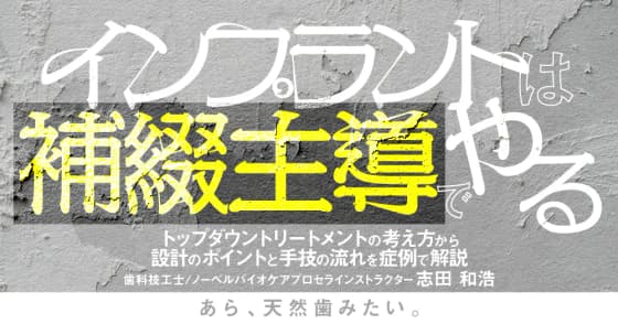 インプラントは補綴主導でやる