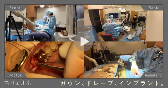 【治療見学】インプラントオペ（下顎左側大臼歯）