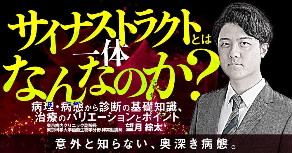 サイナストラクトとは一体なんなのか？